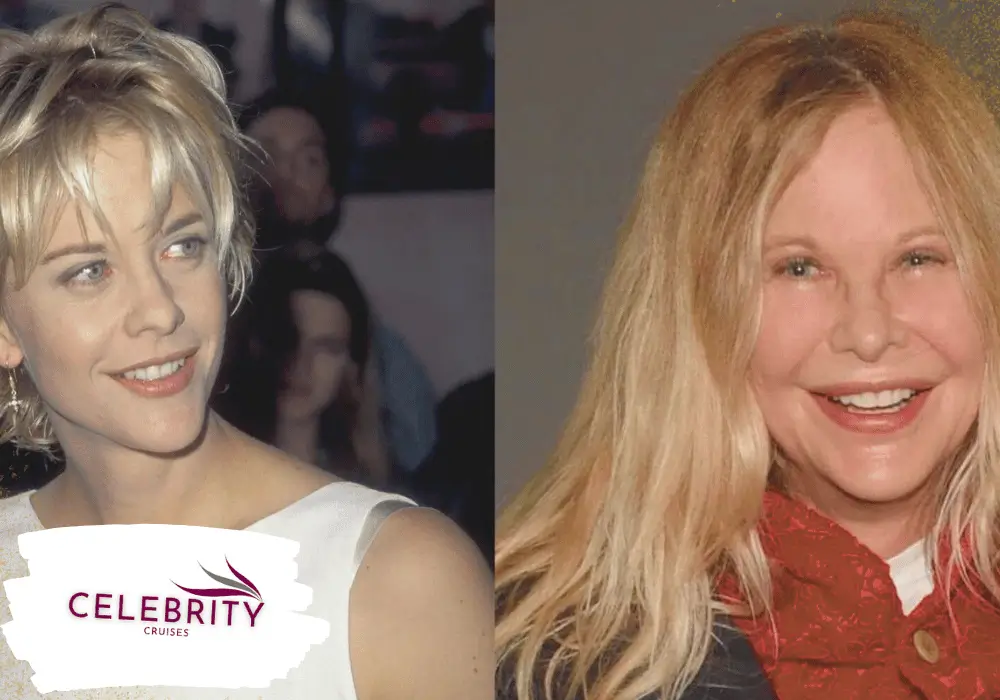 Meg Ryan Plastic Surgery 